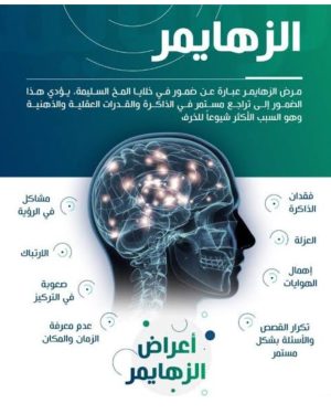 09. الزهايمر & زيادة التركيز