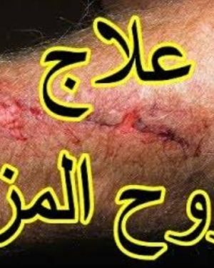 7️⃣⛑ علاج قرح الفراش و الجروح